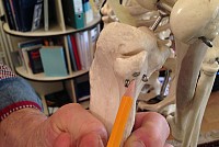 etude implantation tibiale