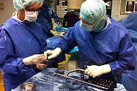 Betz nail clou allongement femoral lengthening nail