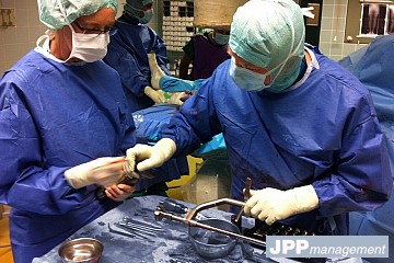 Betz nail clou allongement femoral lengthening nail