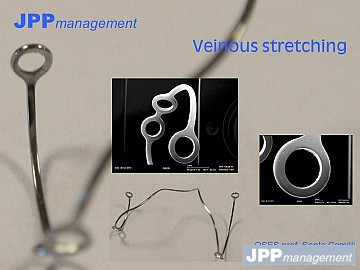 Veinous streching